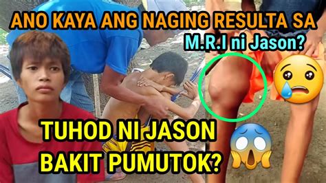 Part 5 ANG SAKIT NI JAYSON IPASA DIYOS NALANG NG TATAY DAHIL SA