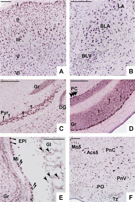 Kaiso Expression In The Central Nervous System A Kaiso Expression In