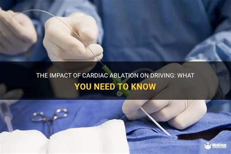 The Impact Of Cardiac Ablation On Driving What You Need To Know Medshun