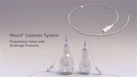 Abdominal Pleurx Catheter