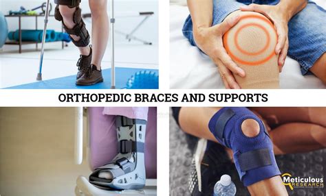 Complete Guide Of Orthopedic Braces And Supports By Research Issuu