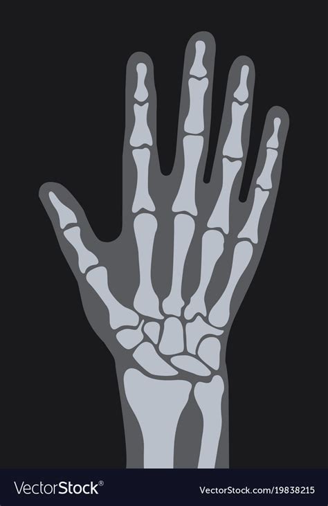 X-ray hand Royalty Free Vector Image - VectorStock