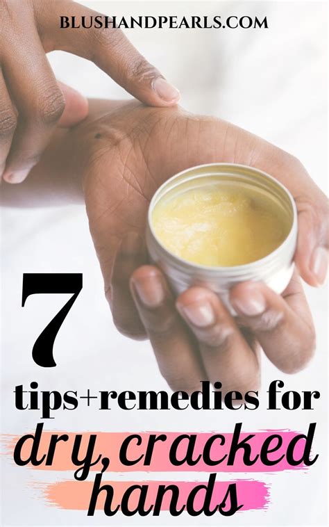 7 Tips Remedies For Dry Cracked Hands Dry Cracked Hands Cracked