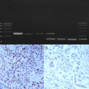 Expression of CUG-binding protein 1 (CUGBP1) and glyceraldehyde ... 