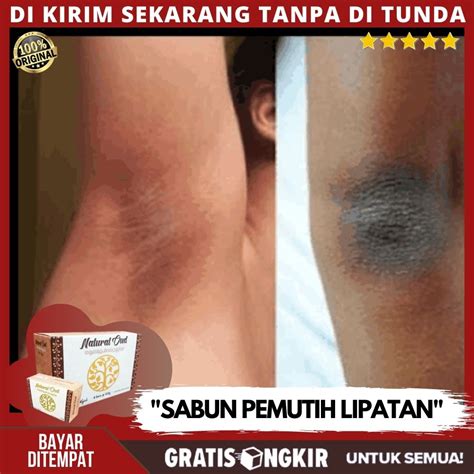 Cara Putihkan Celah Peha Yang Hitam Zoe Smith