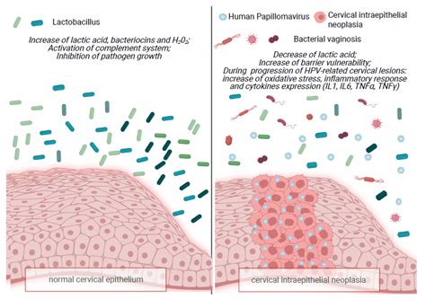 Ijms Free Full Text The Complex Interplay Between Vaginal