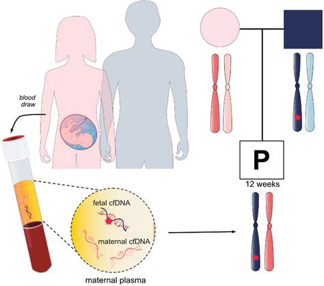 Noninvasive Prenatal Screening For Monogenic Disorders Or Noninvasive