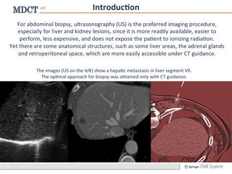 Ct Guided Biopsy Of The Abdomen