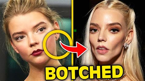 Top 10 Celebrities Who've Gotten BOTCHED From Buccal Fat Removal - YouTube