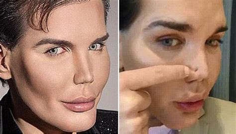 Man Who Spent 280K To Look Like Ken Rushed To Hospital After His