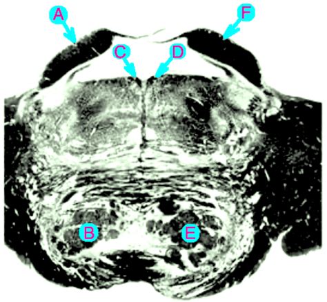 Neuroanatomy preview – July 19, 2020 – MEHLMANMEDICAL