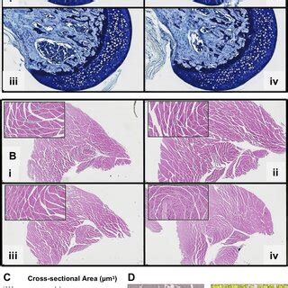 Effect Of Myostatin Inhibition And Microgravity On Femoral Head And