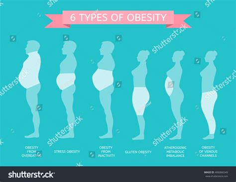 4,305 Types Of Obesity Images, Stock Photos & Vectors | Shutterstock