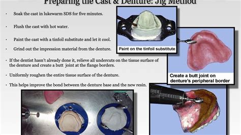 Complete Denture Reline And Rebaseimmediate Denture Surgical Template