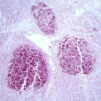 Mycobacterium marinum | Fish Pathogens