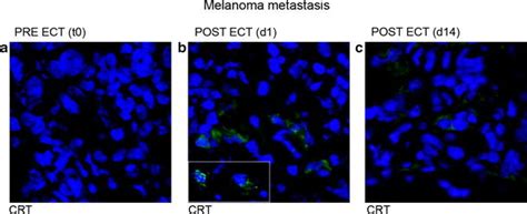 Calreticulin Translocation To The Plasma Membrane After Ect Download Scientific Diagram