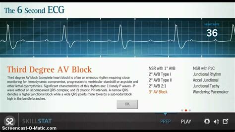 Free Ecg Simulator Practice