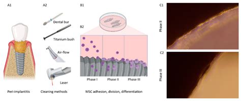 Laser Cleaning Improves Stem Cell Adhesion On The Dental Implant