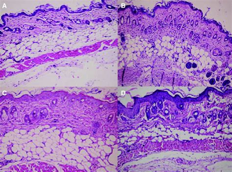 Histopathological Evaluation Of Skin Sections In Balb C Mice Hande Download Scientific Diagram