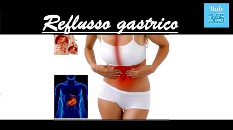 Reflusso Gastrico Quali Sono I Rimedi Naturali Italy 365 YouTube