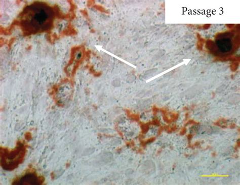 Alizarin Red Staining And Mineralization Assay Of Human Adipose Stem