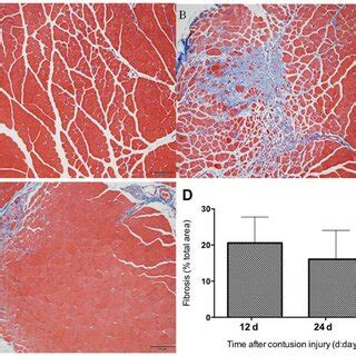 Histological evaluation of scar tissue formation in the injured and... | Download Scientific Diagram