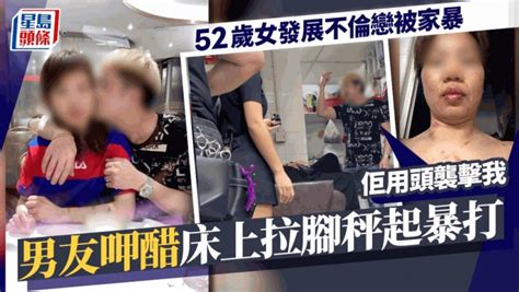 東張西望丨52歲女發展不倫戀被家暴！男友呷醋拉腳秤起暴打 涉事男：佢用頭襲擊我 星島日報