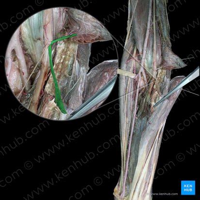 Median Nerve Pediagenosis Median Nerve Nerve Anatomy Sciatic