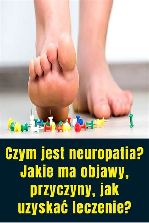 Czym Jest Neuropatia Jakie Ma Objawy Przyczyny Jak Uzyska Leczenie