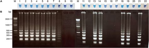 Rapid Visual Detection Of Hepatitis C Virus Using A Reverse