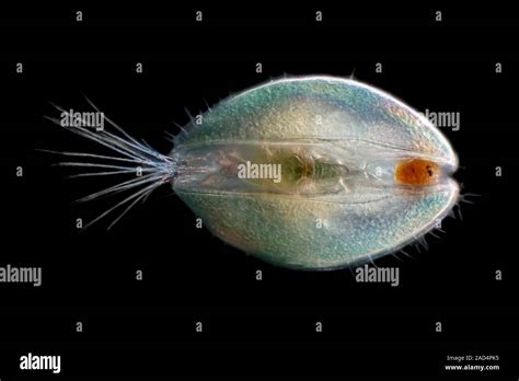 Ostracod Darkfield Illuminated Light Micrograph Of An Ostracod
