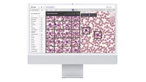 Scopio Full Field Digital Cell Morphology