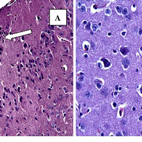 Decreases In Mononuclear Cell Infiltration Arrows Hande 920 And