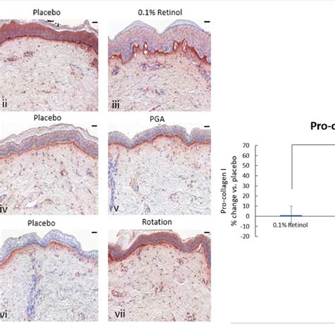 Immunohistology Of Skin Biopsies Volunteers N 32 Received