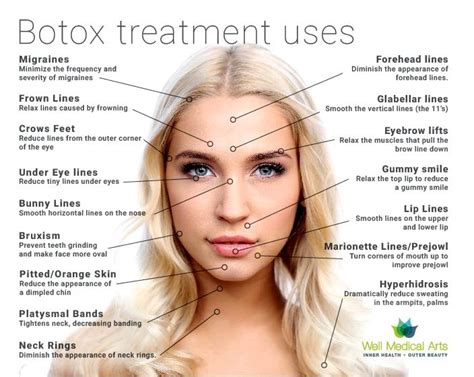 What’s botox treatment negative effects of botox treatment injections ...