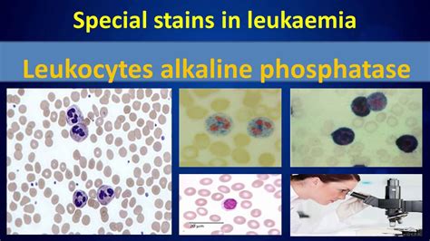 Leukocyte Alkaline Phosphatase Enzymeclear Overview Youtube