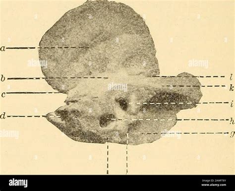 Foramen Ovale Banque De Photographies Et Dimages à Haute Résolution