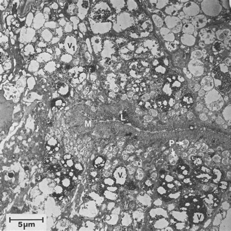 Low Power Electron Micrograph Of The Digestive Gland Of Cepaea