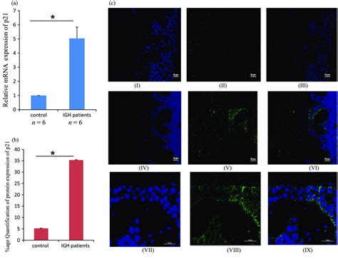 MRNA And Protein Expression Of P21 Senescence Markers In Control Skin