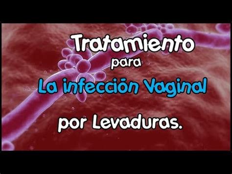 Tratamiento Para La Infecci N Vaginal Por Levaduras Youtube