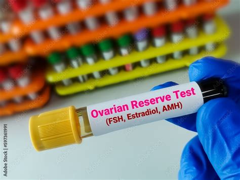 Foto De Doctor Holding A Blood Sample For Ovarian Reserve Test Ort Is