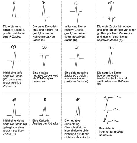 EKG Interpretation Merkmale Des Normalen EKGs P Welle QRS Komplex