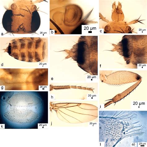 Megaselia Species C Female A Frons B Antenna C Palps And