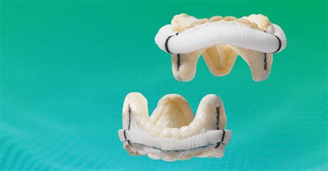 Epic Plus Mitral And Aortic Stented Tissue Valves Abbott