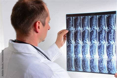 MRI scan of human lumbar spine with doctor. Doctor looking at MRI of ...