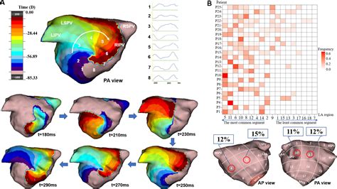 Diverse Activation Patterns During Persistent Atrial Fibrillation By