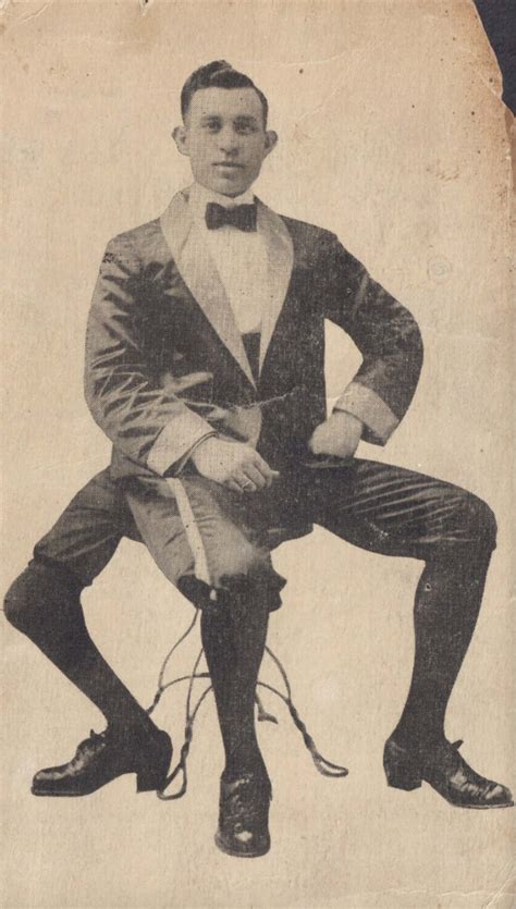 The Strange Life Of Frank Lentini, "The Three-Legged Wonder"