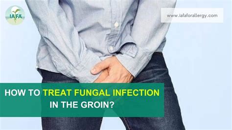 How to Treat Fungal Infection in the Groin?