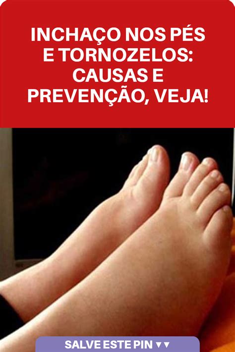 Pin Em Dicas