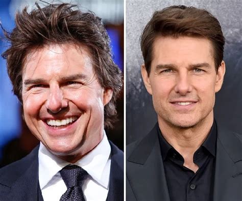 Tom Cruise Before and After Plastic Surgery: Face, Nose, Teeth